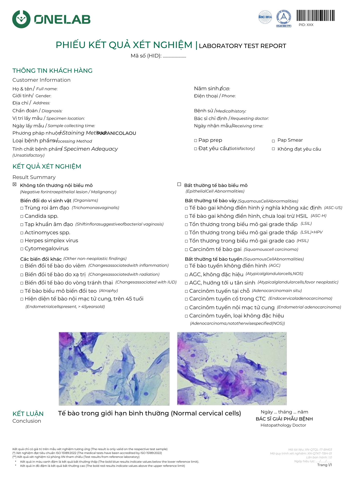 Phiếu kết quả xét nghiệm