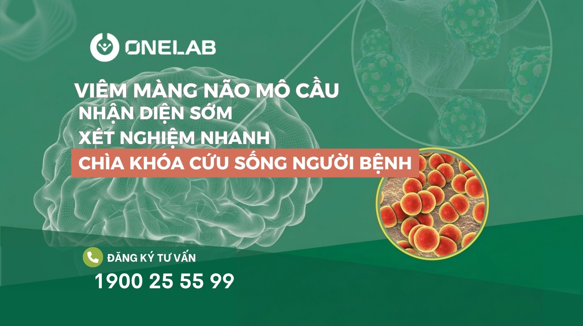 viêm màng não mô cầu